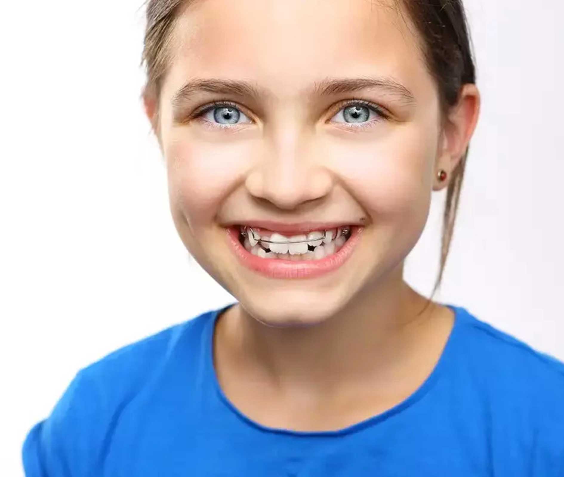 Ortopedia Funcional Maxilar em Maringá